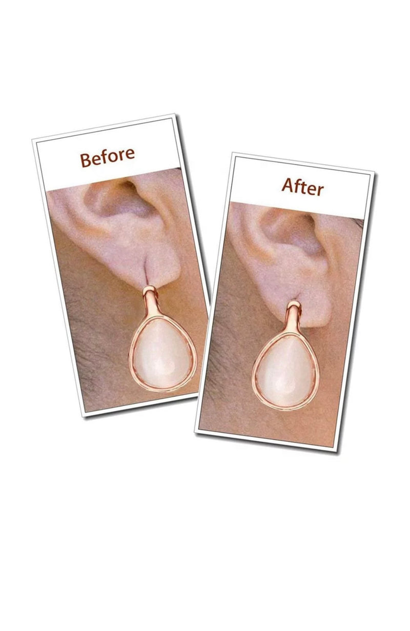 Invisible Earlobe Support Patches
